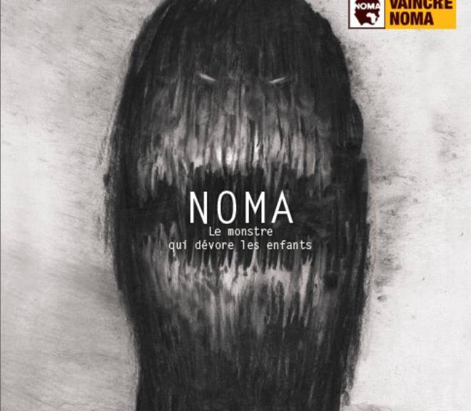 noma