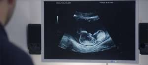echographie syfy