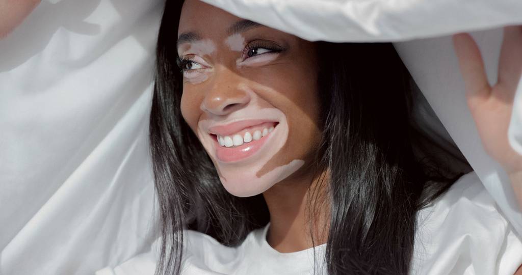 Winnie Harlow dévoile ses moments essentiels pour Casper