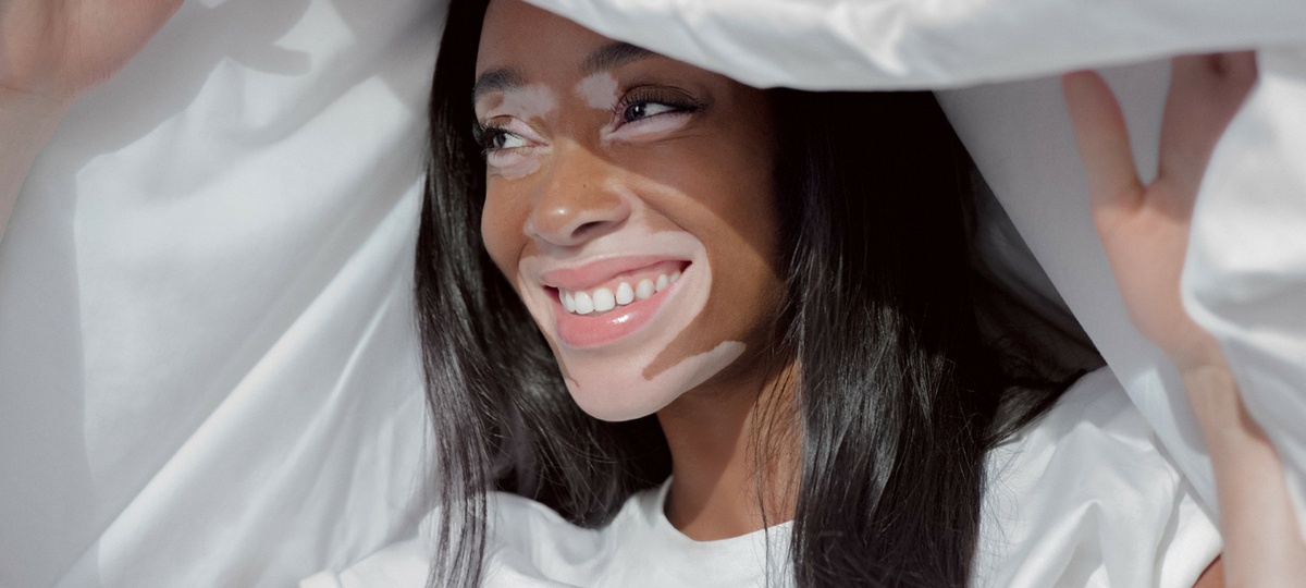 Winnie Harlow dévoile ses moments essentiels pour Casper Winnie Harlow dévoile ses moments essentiels pour Casper