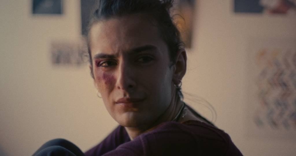 Une fille transgenre avec un bleu sur le visage