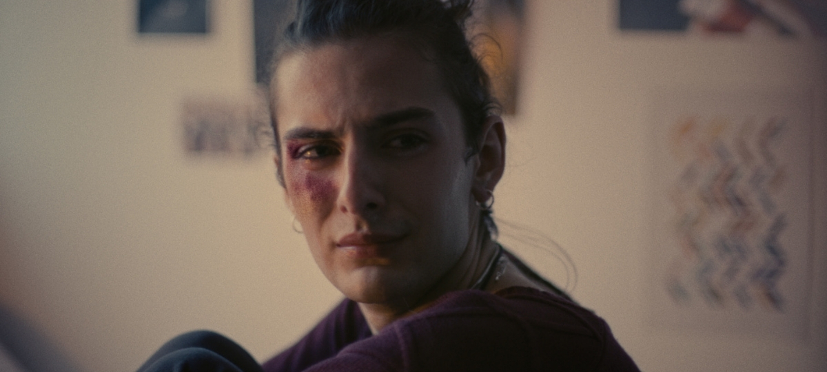 La campagne de sensibilisation de l'Inter-LGBT Une fille transgenre avec un bleu sur le visage